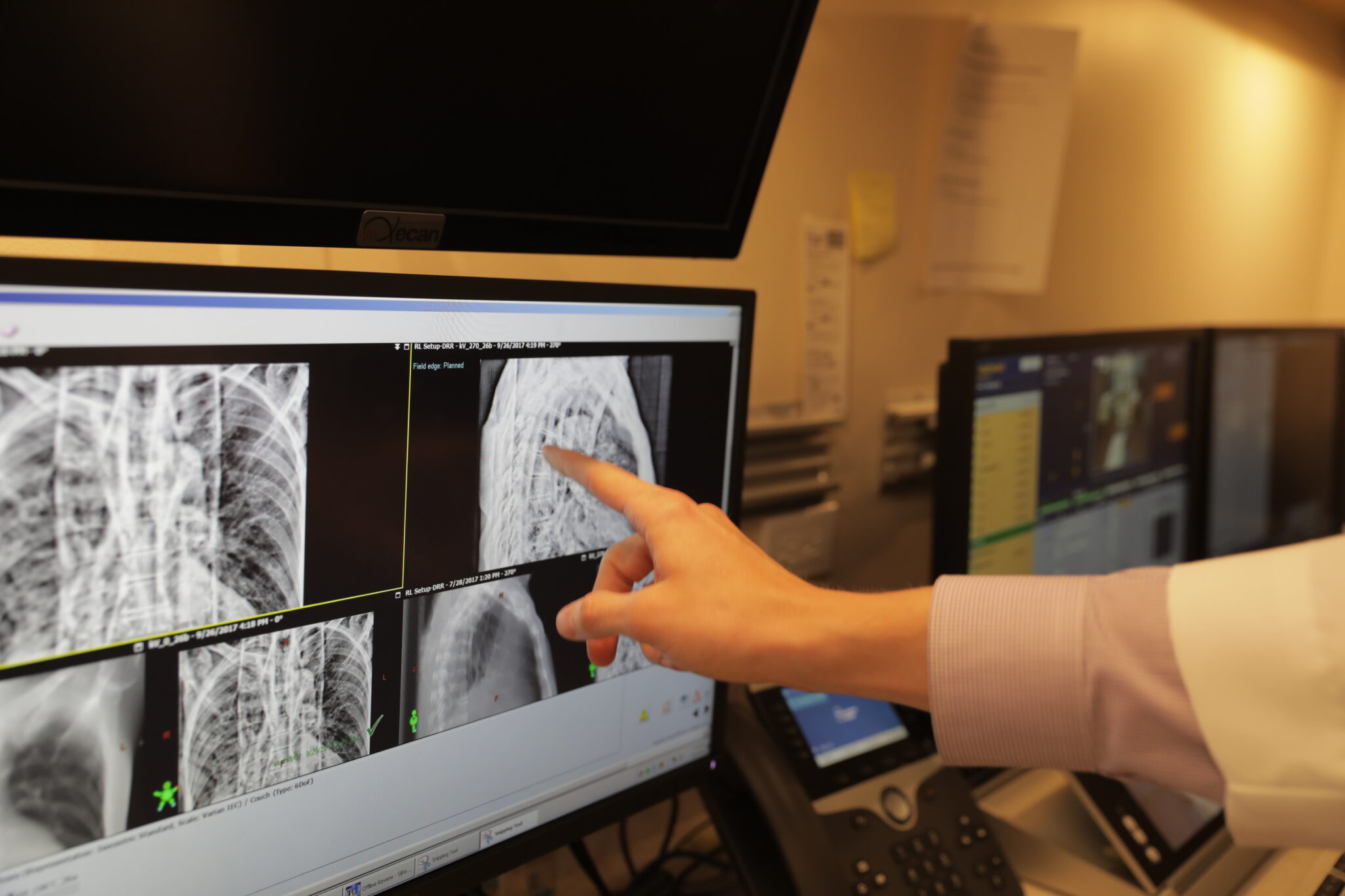 A hand pointing to an area of a computer screen showing a chest scan